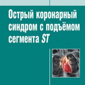 Acute coronary syndrome with the rise of the ST segment: Guide for doctors: Roman Shakhnovich
