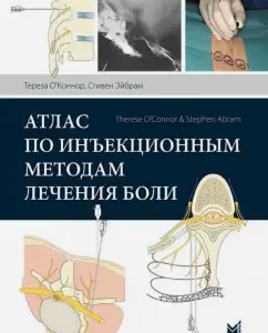 Atlas according to injection methods of painting pain: Aibram