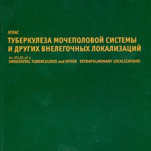 Atlas of tuberculosis of the genitourinary system and other extra -item localizations: Kulchavenya