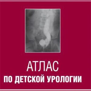 Atlas on children's urology: Kulikova