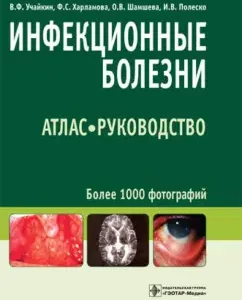 Infectious diseases. Atlas: Guide: Uchykin