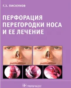 Nasal perforation and its treatment: Gennady Piskunov