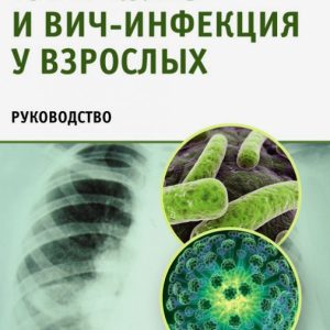Tuberculosis and HIV infection in adults. Guide: Zimina